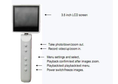 হ্যান্ডহেল্ড ভিডিও ক্যামেরা ডায়াগনস্টিক ভিডিও ডিজিটাল অটোস্কোপ ওফথমোস্কোপ USB আউটপুট ঐচ্ছিক WiFi সংযোগের সাথে