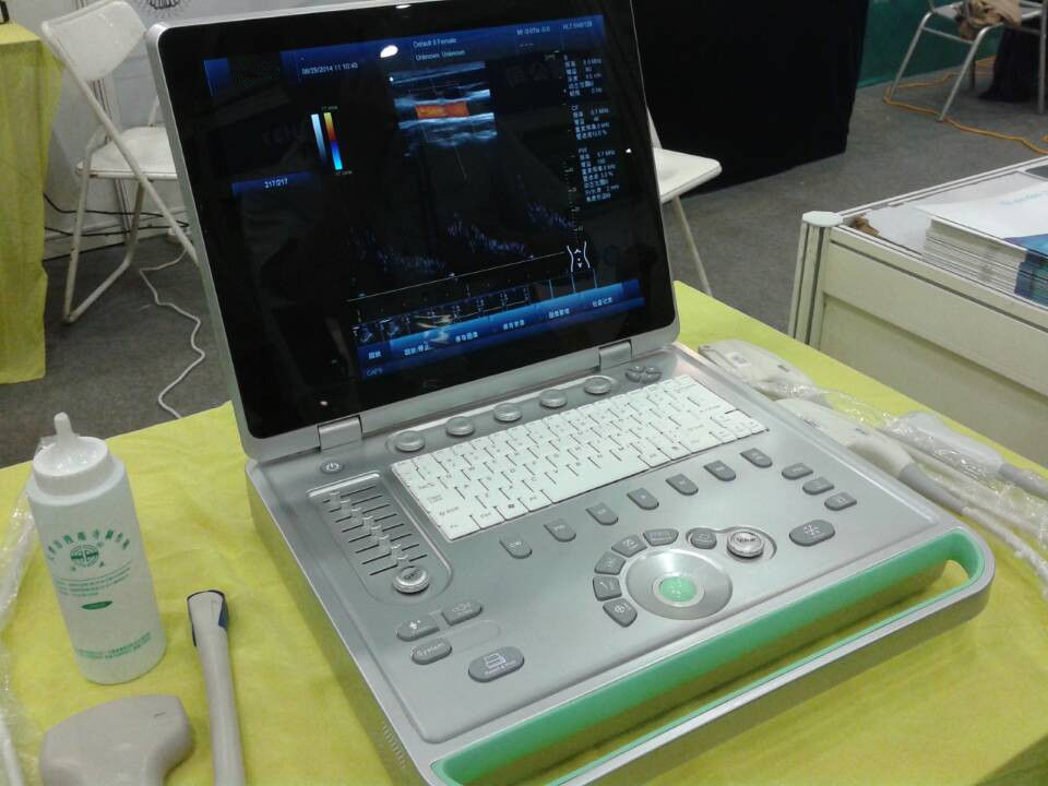 3D Laptop Ultrasound Scanner Color Doppler Machine With Large Volume Hardisk
