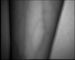 ভাসকুলার ইমেজ স্ক্রিনে ভিনেগার দেখানো নার্সেস এবং ডাক্তারদের জন্য ইনফ্রারেড শিরা ফাইন্ডার