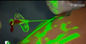 উচ্চ বৈপরীত্য চিত্র প্রজেকশন দ্বারা মেডিকেল প্যাচনার জন্য শিরা হালকা শিরা লোকেটার ডিভাইস
