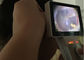 ENT এন্ডোস্কোপ ডিজিটাল ভিডিও অটোস্কোপ এসডি কার্ড আউটপুট ইউএসবি অটোস্কোপ সহ সম্পূর্ণ ডিজিটাল পরিদর্শন