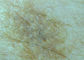 কালো সিলিকন ডিজিটাল ওয়্যারলেস ভিডিও ডার্মাটোস্কোপ স্কিন স্ক্যানার পিসি বা ফোন থেকে সংযুক্ত