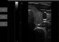 পকেট আল্ট্রাসোনিক ডায়াগনস্টিক সরঞ্জাম পোর্টেবল আল্ট্রাসাউন্ড স্ক্যানার সমর্থিত উইন্ডো 10 ভেট ব্যবহার উপলব্ধ