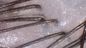 চুলের ত্বকের বিশ্লেষণ ভিডিও ডার্মাটোস্কোপ ত্বকের জলের তেল পিগমেন্ট নমনীয় আবিষ্কারক ডেটা রিপোর্টের সাথে