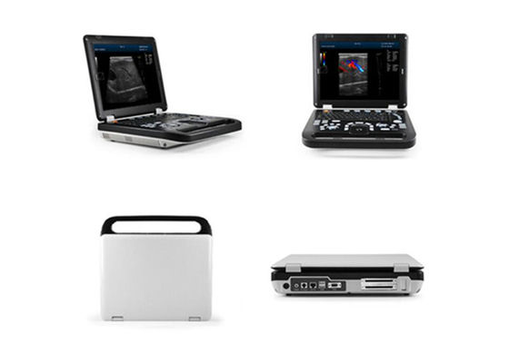 15 ইঞ্চি LED ডায়াগনস্টিক হিউম্যান আল্ট্রাসাউন্ড স্ক্যানার এক প্রোব সংযোগ এবং দুটি ইউএসবি পোর্ট