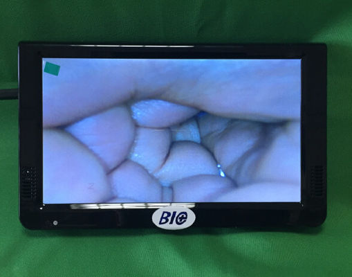 পোর্টেবল ডিজিটাল ইলেকট্রনিক কলপোস্কোপ