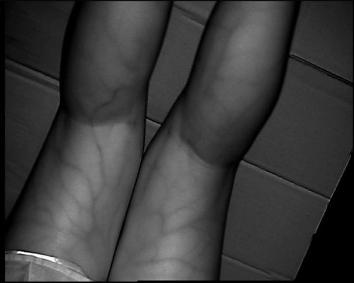 800X480 Table Type Vein Locator Device