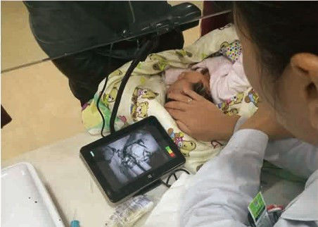 পোর্টেবল অর্থনৈতিক ইনফ্রারেড শিরা অনুসন্ধানকারী শিরা ট্রলি প্রায় 10 মিমি গভীরতা উপলব্ধ সনাক্তকরণ