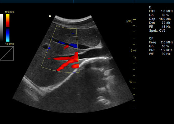 15 ইঞ্চি পূর্ণ ডিজিটাল রঙ ডপলার মেশিন পোর্টেবল ডপলার ইমেজিং 2 ইউএসবি পোর্টের সাথে আল্ট্রাসাউন্ড