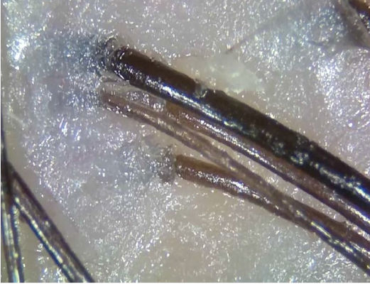 পোর্টেবল ওয়্যারলেস ডিজিটাল স্কিন অ্যানালাইজার পোলারাইজ আলোর সাথে টেলিমেডিসিন ডায়াগনোসিস ডিভাইস