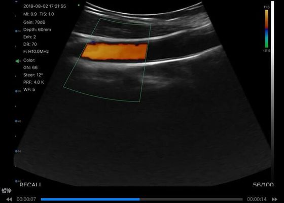 ডিজিটাল ওয়্যারলেস হ্যান্ডহেল্ড আল্ট্রাসাউন্ড স্ক্যানার