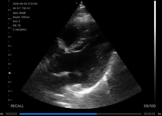 ডিজিটাল ওয়্যারলেস হ্যান্ডহেল্ড আল্ট্রাসাউন্ড স্ক্যানার