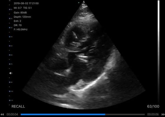5 জি হ্যান্ডহেল্ড আল্ট্রাসাউন্ড স্ক্যানার উত্তল: 3.5 ~ 5 মেগাহার্টজ, লিনিয়ার: 7.5 ~ 10 মেগাহার্টজ, কার্ডিয়াক: 2.5 ~ 5 মেগাহার্টজ