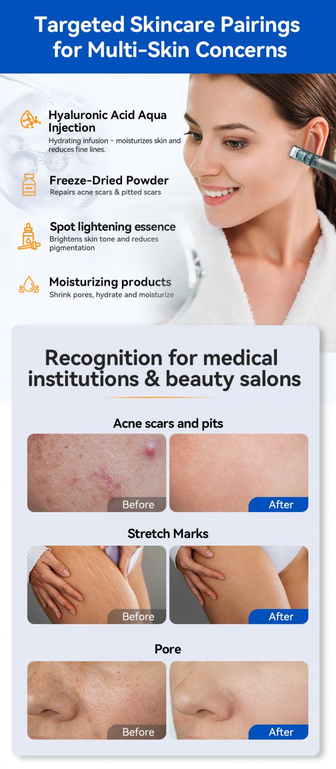 নতুন আগমন হাইড্রা পেন এইচ৫ মেসোথেরাপি সিরাম অ্যাপ্লিকেটর সৌন্দর্য ত্বকের যত্ন বায়ো এক্সোসোম ডার্মা মাইক্রোনেডলিং পেন 6