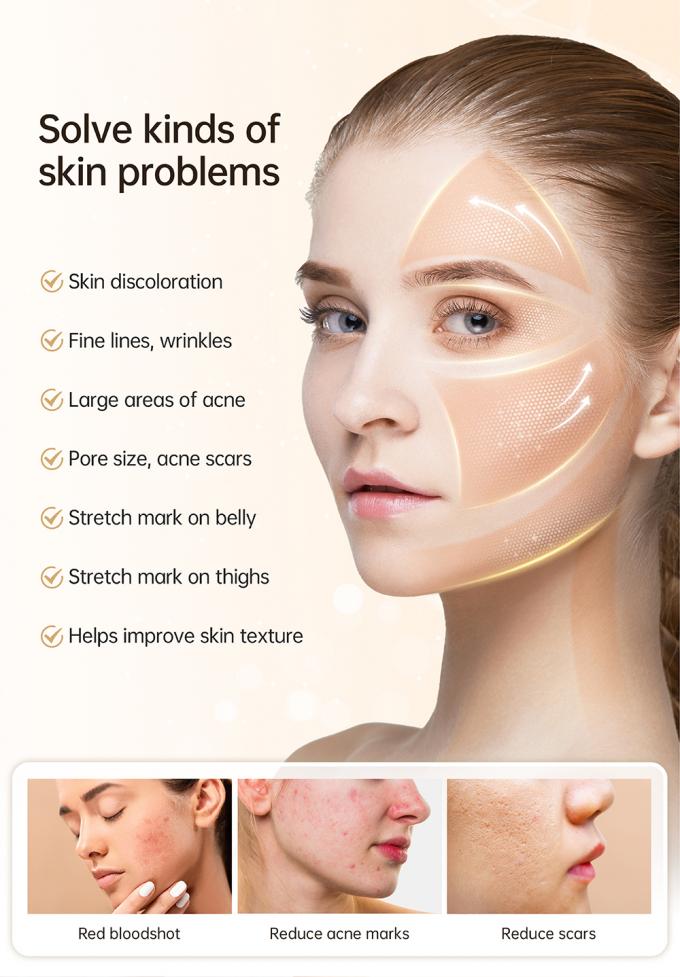 সর্বশেষ ৪-মেরু ইএমএস স্বয়ংক্রিয় সিরাম অ্যাপ্লিকেটর হাইড্রা পেন এইচ৫ ফেস স্কিন ডার্মা মাইক্রোনিডলিং পেন এসেন্স কোলাজেন পুনর্জন্ম 3