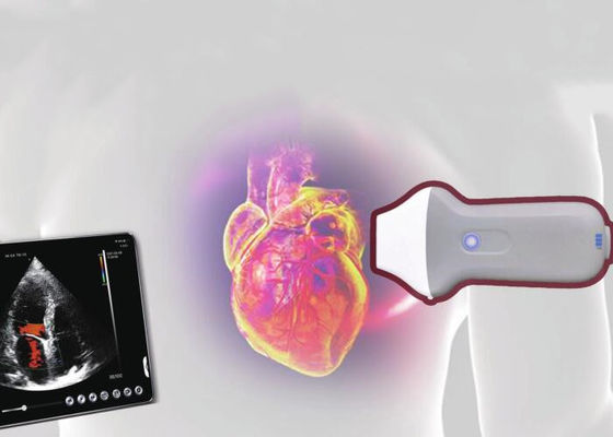 PDI ওয়াইফাই ওয়্যারলেস পোর্টেবল আল্ট্রাসাউন্ড স্ক্যানার 128 উপাদান